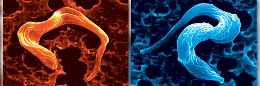 Scanning Electron Microscopy images of the parasite Trypanosoma brucei 
