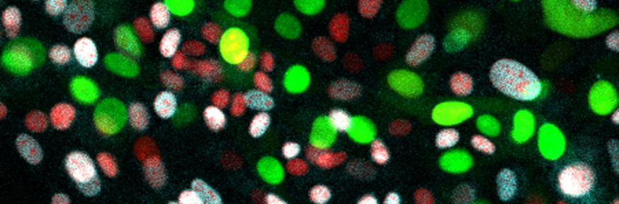 Fibroblasts labelled with Fucci biosensors